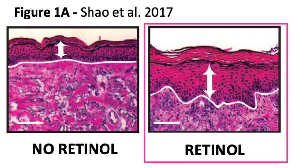 retinol effects on the skin