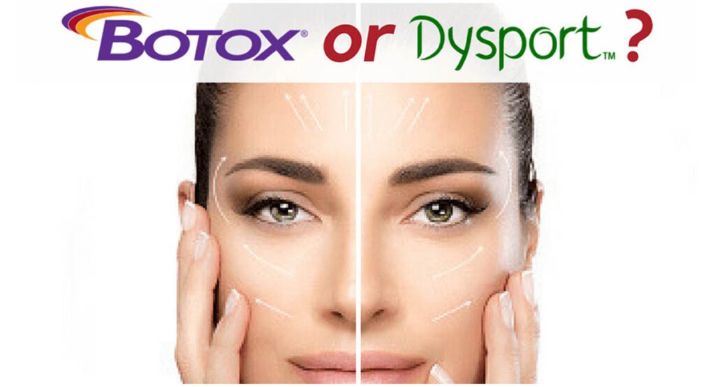 Botox vs Dysport